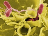 Wikimedia.org nuotr./Salmonelės bakterija