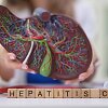 Hepatitas