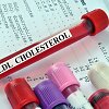 Cholesterolis