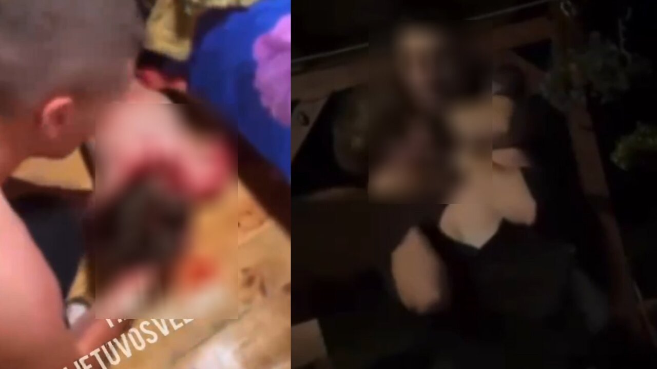 Po pranešimų apie galimą žiaurų jaunuolio sumušimą Druskininkuose policija pradėjo tyrimą