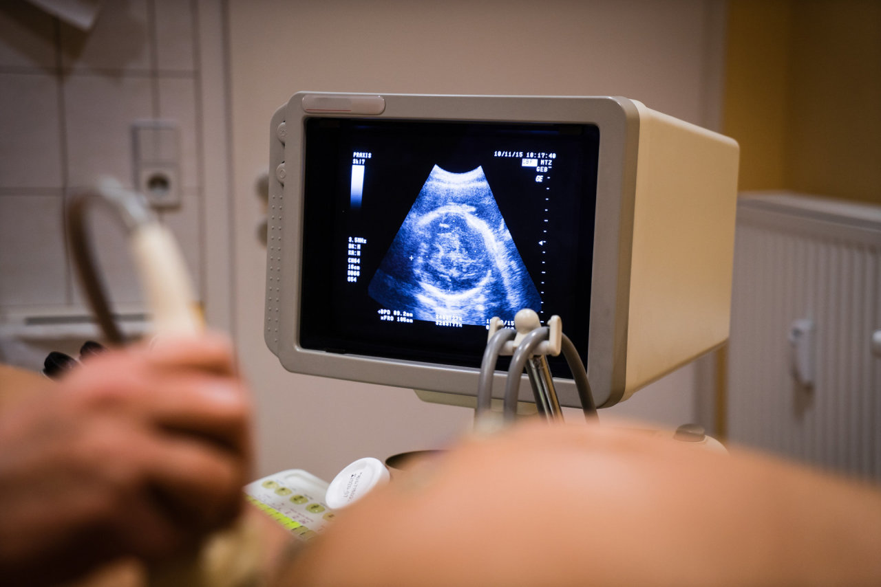 Nuo kitų metų Lietuvoje įteisintas medikamentinis nėštumo nutraukimas