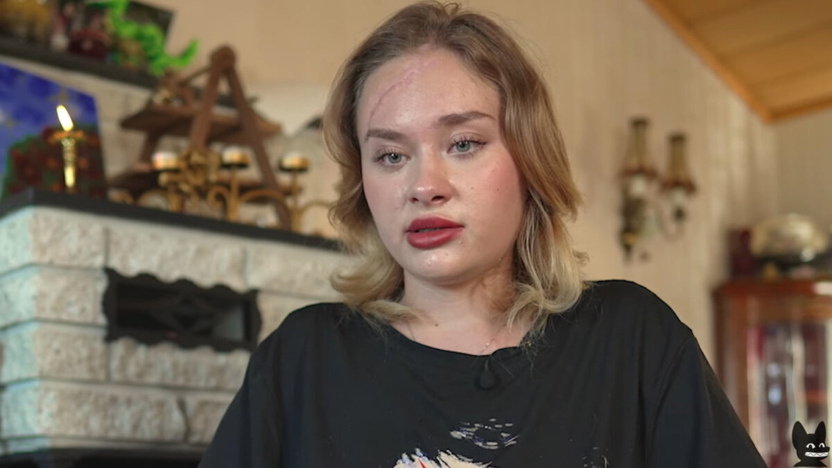Pirmąkart prabilo Dubajuje žiauriai sužalota Maria Kovalchuk – atskleidė, ką padarė Rusijos „auksinis“ jaunimas | Žmonės.lt