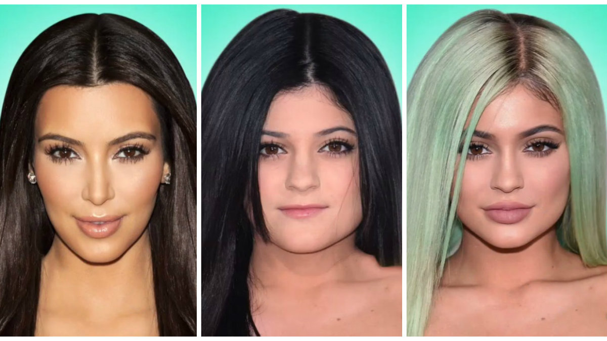 Kim Kardashian ir Kylie Jenner išvaizdos pokyčiai