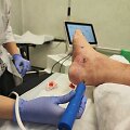 Prie&scaron; kelerius metus po apsilankymo Melnragės paplūdimyje Vytautas pėdoje pastebėjo rausvą odos darinį. Tuomet jis nė neįtarė, kad tai &ndash; pirmasis retos ir klastingos ligos, Kapo&scaron;i sarkomos, požymis. 