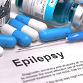Diagnozė &ndash; epilepsija.