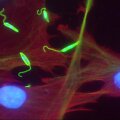 Leishmania major (žalia spalva) &scaron;eimininko ląstelėse (raudona spalva žymi citoplazmą, mėlyna &ndash; branduolius)