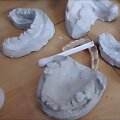 Kaunietis dantų protezavimo paslaugas atliko antisanitarinėmis sąlygomis