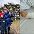 Ilona su sūnumi prie&scaron; nelaimę ir berniuko koja po antrosios operacijos