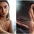 Svetlana nudegusi daugiau kaip pusę kūno tapo modeliu ir įkvepia kitus