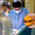 Kepenų transplantacija