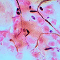 Grybelis Candida albicans