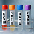 Biologiniai mėginiai (asociatyvi nuotr.)
