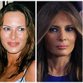 Melania Trump 1987, 1998 ir 2016 metais