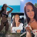 Ieva Swan pasidalijo perspėjimu apie &scaron;alutinį botokso poveikį