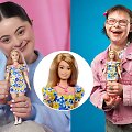 Naujausia Barbė, vaizduojanti Dauno sindromą turinį asmenį