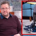 Dėl liguistos seksualinės fantazijos amputavosi kojas