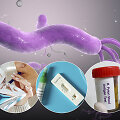 H.pylori diagnostikos būdai