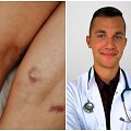 Mėlynės ant kūno / Gydytojas hematologas