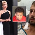 Lady Gaga, Ryanas Fischeris, Jamesas Howardas Jacksonas