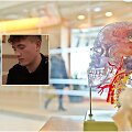 Jauniausias žmogus pasaulyje, kuriam diagnozuota Alzheimerio liga