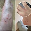 Po maudynių ežere ant kūno &ndash; bjaurūs niežtintys bėrimai