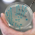 E.coli bakterijos tyrimai