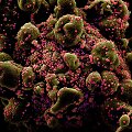 Vyksta ląstelės, prigaminusios gausybę SARS-CoV-2 viruso, apoptozė