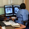 Tuberkuliozės atvejų &scaron;alyje pastaraisiais metais vis mažėja: tai gali lemti ir pagerėjęs i&scaron;ai&scaron;kinimas, ir finansavimas.