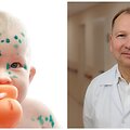 Vėjaraupiais sergantis vaikas/terapijos skyriaus vadovas Darius Vara&scaron;kevičius