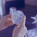 Tuberkuliozės sukėlėja &ndash; mikobakterija