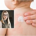 Alergija / Gydytoja alergologė dr. Ieva Adomaitė