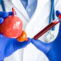 Prostatos vėžys &ndash; dažniausia vyrų onkologinė liga