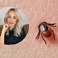 Lijana