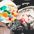 Epilepsija