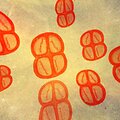 Deinococcus radiodurans