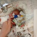 Klaudija gimė 22 savaičių ir 360 gramų svorio 