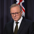 Anthony Albanese / LUKAS COCH / via REUTERS