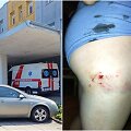 Kėdainių rajone palaidas &scaron;uo užpuolė ir apkandžiojo &scaron;e&scaron;iametį berniuką.