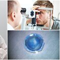 Akių ligų centro gydytojas Almantas Makselis (kairėje) &ndash; apie atliekamas endotelio transplantacijas
