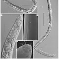 I&scaron; Sibiro amžinojo į&scaron;alo atitirpinti gyvi nematodai