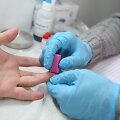 Europos aik&scaron;tėje siūloma nemokamai pasidaryti greitąjį ŽIV testą.