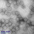 E.coli bakteriją infekuojantis Caldo virales (liet. uodeguotieji virusai) būrio virusas Js20