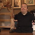 Kevinas Donnellonas, vienas konferencijos dalyvių, nukentėjęs nuo talidomido.