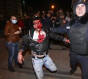 Doneceke sužeistas protestuotojas