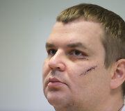 Automaidano lyderio ukrainiečio Dmytro Bulatovo spaudos konferencija