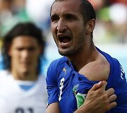 Giorgio Chiellini rodo ant peties likusias Urugvajaus futbolininko Luiso Suarezo kandimo žymes