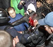 Donecke sužeistas protestuotojas