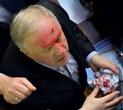 Ukrainos parlamente per mu&scaron;tynes sužeistas deputatas