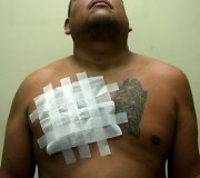 Salvadoro gaujų nariai naikina gaujų priklausomybę žyminčias tatuiruotes, kad pradėtų gyvenimą i&scaron; naujo