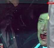 Užpuolikas smarkiai sužalojo Italijos premjero veidą.